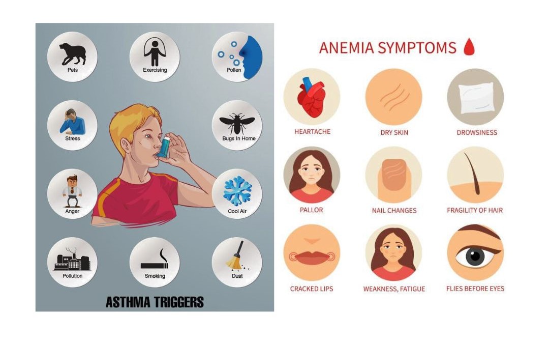 Asthma